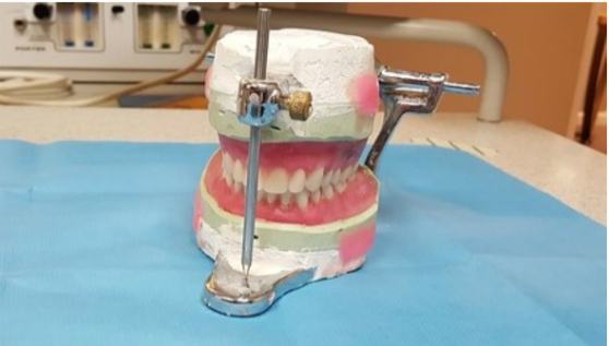 Cirurgia ortognática corrige deformidades na face