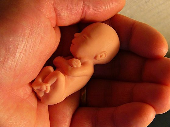 Obstetra, parteira e doula: afinal, o que é parto normal?